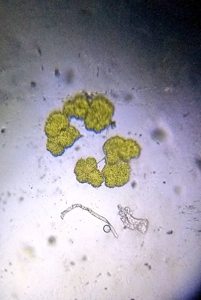  image of floating bits of algae/vegetation