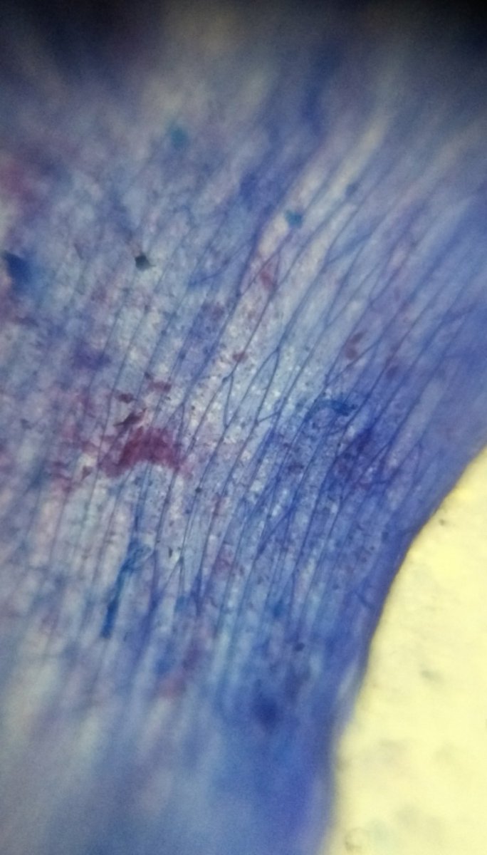  image of iodine staining