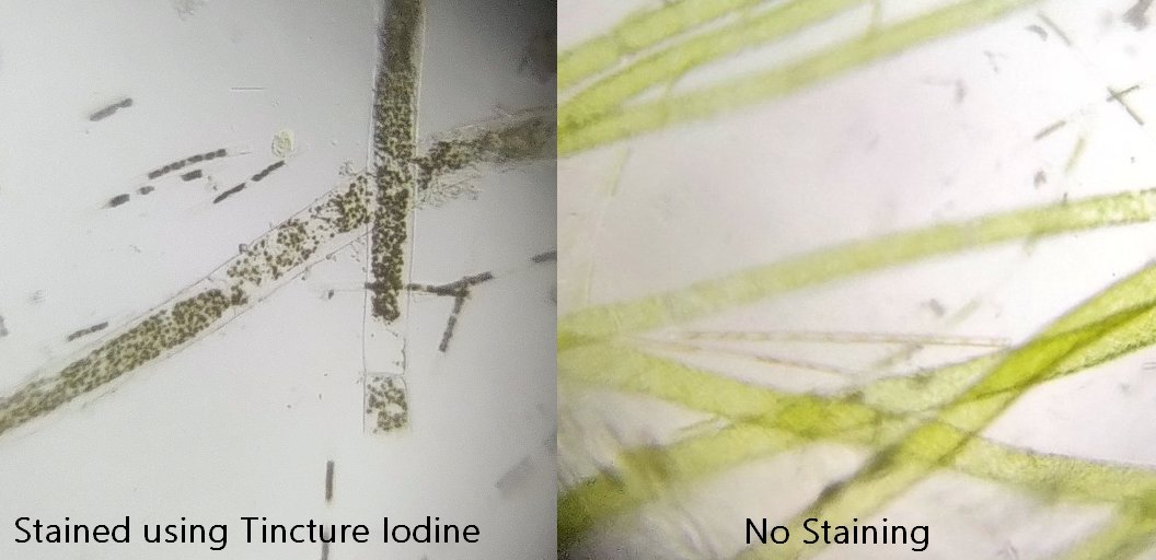  image of no staining results